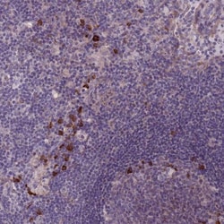 Lymphotoxin beta/TNFSF3 Antibody, Novus Biologicals 25 &mu;L, Unlabeled:Antibodies,